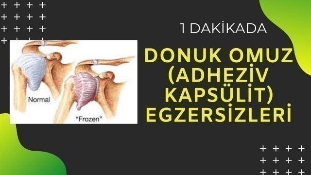 '1 Dakikada Donuk Omuz (Adheziv Kapsülit) Egzersizleri - Frozen shoulder exercises in 1 minute'